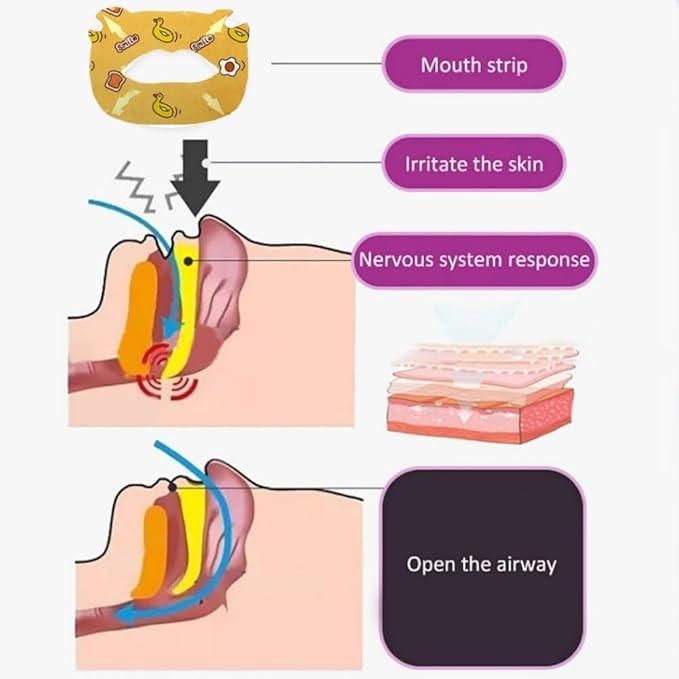 Anti Snoring Sticker for Children 30 Pcs
