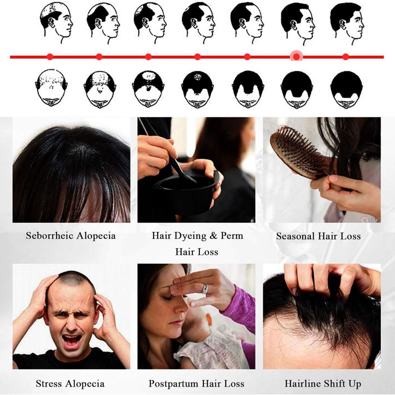 Ellohe Anti Hair Loss Hair Growth Fluid 60 ML Pack of 1