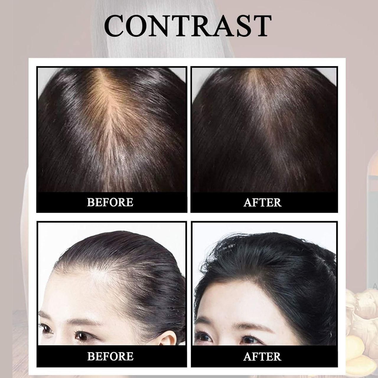 Ellohe Anti Hair Loss Hair Growth Fluid 60 ML Pack of 1